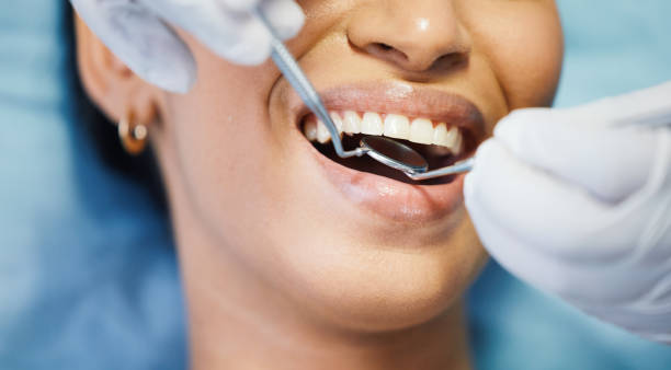 Best Weekend Emergency Dentist in Egan, LA